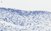 Anti-Bak Antibody, clone 2D18 ZooMAb Rabbit Monoclonal 