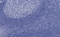 Anti-BCL-11A Antibody, clone 3B12 ZooMAb Rabbit Monoclonal 