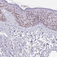 Anti-BCL11A antibody produced in rabbit 
