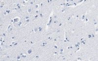 Anti-BDNF Antibody, clone 1I14 ZooMAb Rabbit Monoclonal 