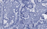 Anti-Beclin 1 Antibody, clone 1E22 , ZooMAb Rabbit Monoclonal 