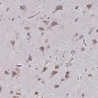 Anti-BEND6 antibody produced in rabbit 