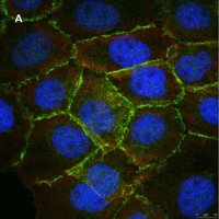 Anti-beta Catenin Antibody, clone 3J7, ZooMAb Rabbit Monoclonal 