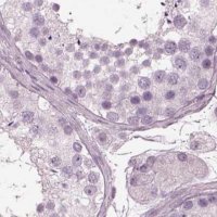 Anti-BFSP1 antibody produced in rabbit 
