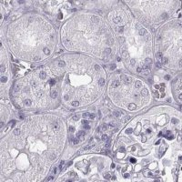 Anti-BFSP2 antibody produced in rabbit 