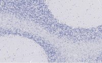 Anti-Bin1 Antibody, clone 99D.2 ZooMAb Mouse Monoclonal 