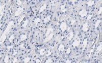 Anti-Bmi-1 Antibody, clone 1G8 ZooMAb Rabbit Monoclonal 