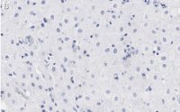 Anti-BMI-1 Antibody, clone F6 ZooMAb Mouse Monoclonal 