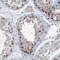 Anti-BMI1 antibody produced in rabbit 