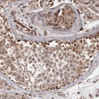 Anti-BRAT1 antibody produced in rabbit 