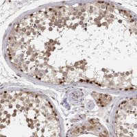 Anti-BRCA1 