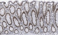 Anti-BRG1 Antibody, clone 1N12, ZooMAb Rabbit Monoclonal 