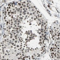 Anti-BRIP1 antibody produced in rabbit 