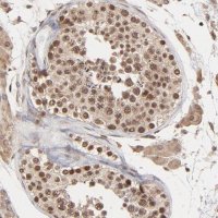 Anti-BRPF1 antibody produced in rabbit 