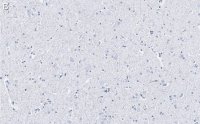 Anti-BSN Antibody, clone 2I2 ZooMAb Rabbit Monoclonal 