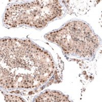 Anti-BTBD7 antibody produced in rabbit 