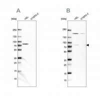 Anti-BTK antibody produced in rabbit 