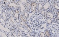 Anti-c-Myc Antibody, clone 7E18, ZooMAb Rabbit Monoclonal 