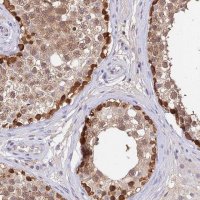 Anti-C10orf55 antibody produced in rabbit 