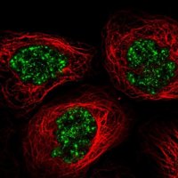 Anti-C11orf84 antibody produced in rabbit HPA050313-100UL