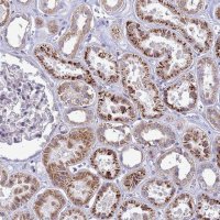 Anti-C12orf43 antibody produced in rabbit 
