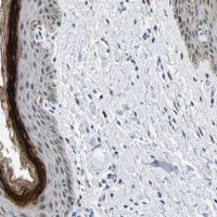 Anti-C14orf177 antibody produced in rabbit HPA018091-100UL