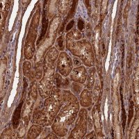 Anti-C16orf70 antibody produced in rabbit 