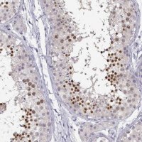 Anti-C16orf86 antibody produced in rabbit 