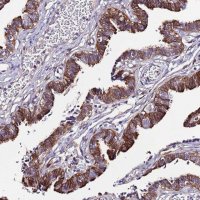 Anti-C19orf24 antibody produced in rabbit 