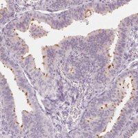 Anti-C1orf194 antibody produced in rabbit 