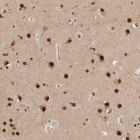Anti-C1orf21 antibody produced in rabbit 