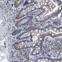 Anti-C20orf196 antibody produced in rabbit 