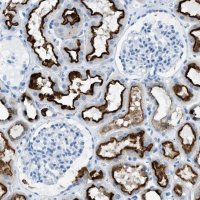 Anti-C21orf62 antibody produced in rabbit 