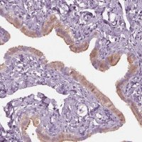 Anti-C2orf81 antibody produced in rabbit 