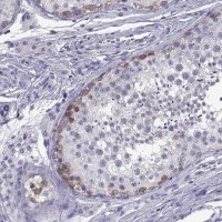 Anti-C3orf22 antibody produced in rabbit 
