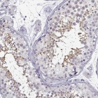 Anti-C3orf30 antibody produced in rabbit 