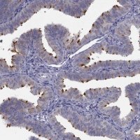 Anti-C5ORF49 antibody produced in rabbit 