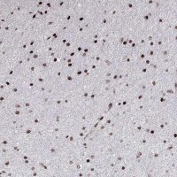 Anti-C6orf1 antibody produced in rabbit 