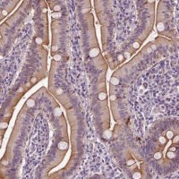 Anti-C6orf106 antibody produced in rabbit HPA034490-100UL