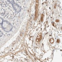 Anti-C8B antibody produced in rabbit HPA023694-100UL