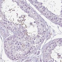 Anti-C9ORF24 antibody produced in rabbit 