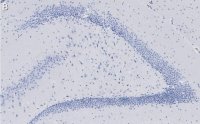 Anti-C9ORF72 (long form) Antibody, clone 1I9 ZooMAb Rabbit Monoclonal 