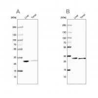Anti-CA3 antibody produced in rabbit HPA021775-100UL