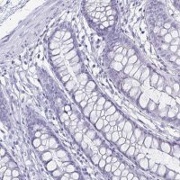 Anti-CA9 antibody produced in rabbit 