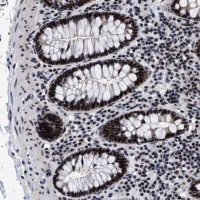 Anti-CAAP1 antibody produced in rabbit 