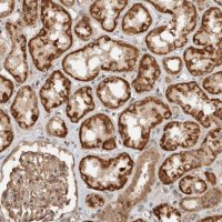 Anti-CAAP1 antibody produced in rabbit HPA024029-100UL