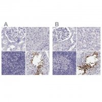 Anti-CABS1 antibody produced in rabbit 