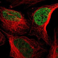 Anti-CACFD1 antibody produced in rabbit 