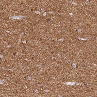 Anti-CACNA1A antibody produced in rabbit 