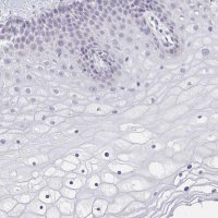 Anti-CACNA1S antibody produced in rabbit 